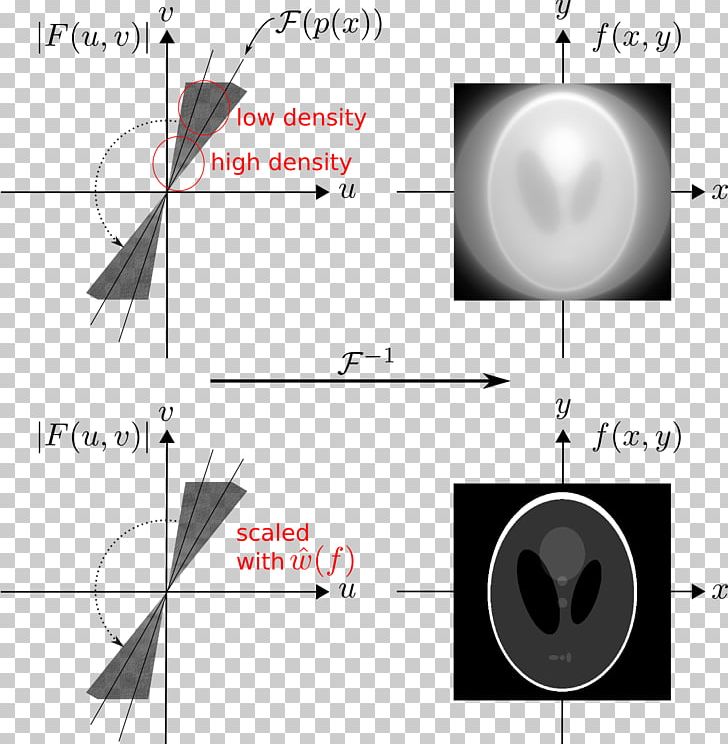 Light Line PNG, Clipart, Angle, Circle, Computed Tomography, Diagram, Eye Free PNG Download