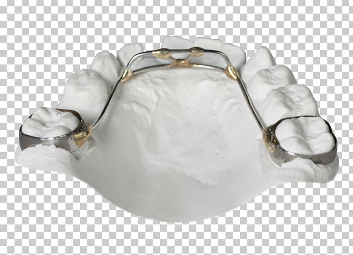 Gergen's Orthodontic Lab Orthodontics Tongue Sagittal Plane Retainer PNG, Clipart, Bionator, Body Jewellery, Body Jewelry, Clear Aligners, Cots Free PNG Download