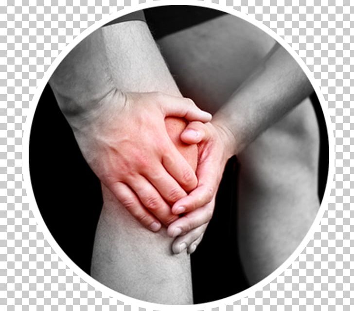 Knee Pain Hamstring Knee Arthritis Baker's Cyst PNG, Clipart,  Free PNG Download