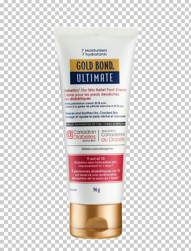 Cream Lotion Xeroderma Gold Bond Diabetes Mellitus PNG, Clipart, Cream, Diabetes Mellitus, Diabetic Foot, Dryness, Foot Free PNG Download