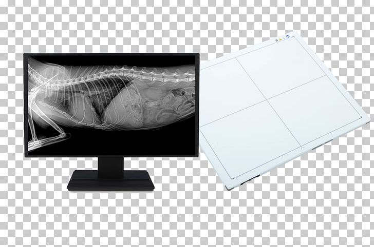 Digital Radiography Medical Imaging X-ray Radiology PNG, Clipart, Angle, Digital Radiography, Efficiency, Flat Panel Display, Laptop Free PNG Download