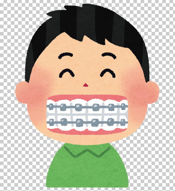 Dentist Dental Braces 矯正歯科 Therapy PNG, Clipart, Cartoon, Cheek, Dental Braces, Dental Hygienist, Dental Surgery Free PNG Download