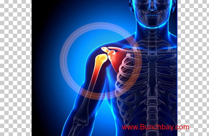 Shoulder Pain Shoulder Joint Impingement Syndrome Injury PNG, Clipart, Anatomy, Bottle, Bursitis, Clavicle, Dislocated Shoulder Free PNG Download
