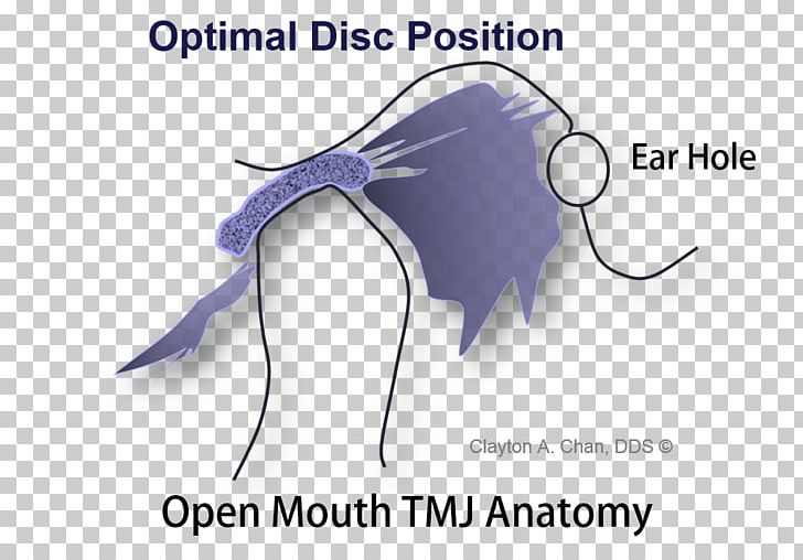Temporomandibular Joint Dysfunction Anatomy Mandible PNG, Clipart, Anatomy, Articular Disk, Blue, Bone, Brand Free PNG Download