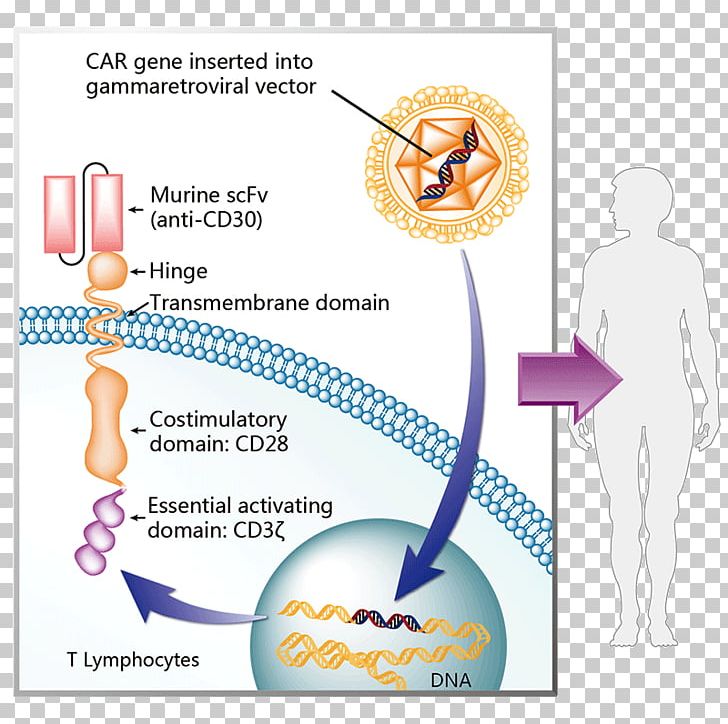 Chimeric Antigen Receptor Axicabtagene Ciloleucel Tisagenlecleucel Therapy Cancer PNG, Clipart, Acute Lymphoblastic Leukemia, Antigen, Area, Axicabtagene Ciloleucel, Cancer Immunotherapy Free PNG Download