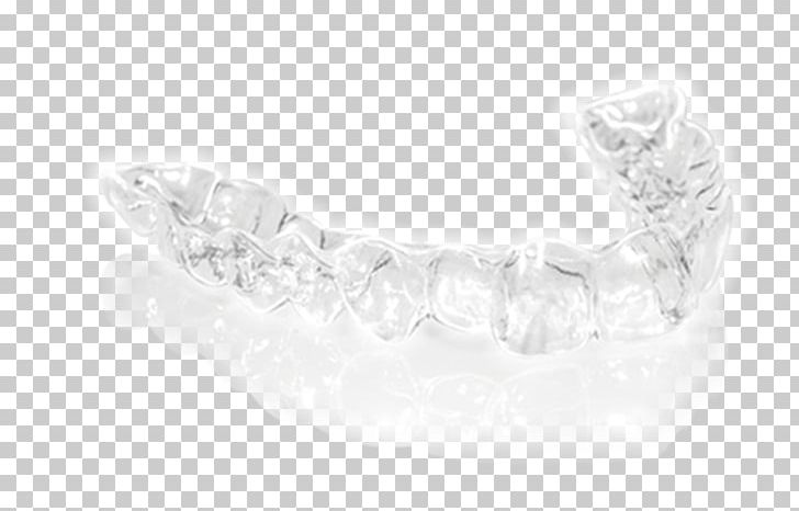 Silver Body Jewellery Jaw PNG, Clipart, Body, Body Jewellery, Body Jewelry, Clear Aligners, Diamond Free PNG Download