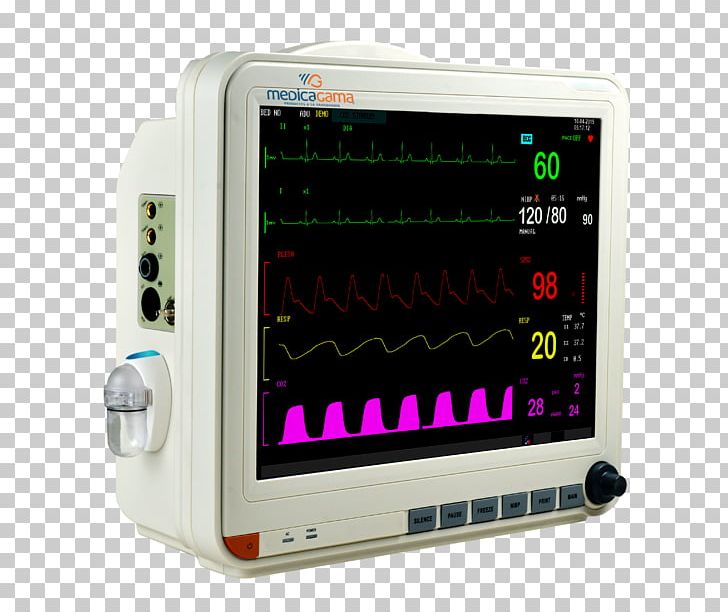 Display Device Monitoring Intensive Care Unit Vital Signs Patient PNG, Clipart, Agama, Computer Monitors, Display Device, Electrocardiography, Electronic Device Free PNG Download