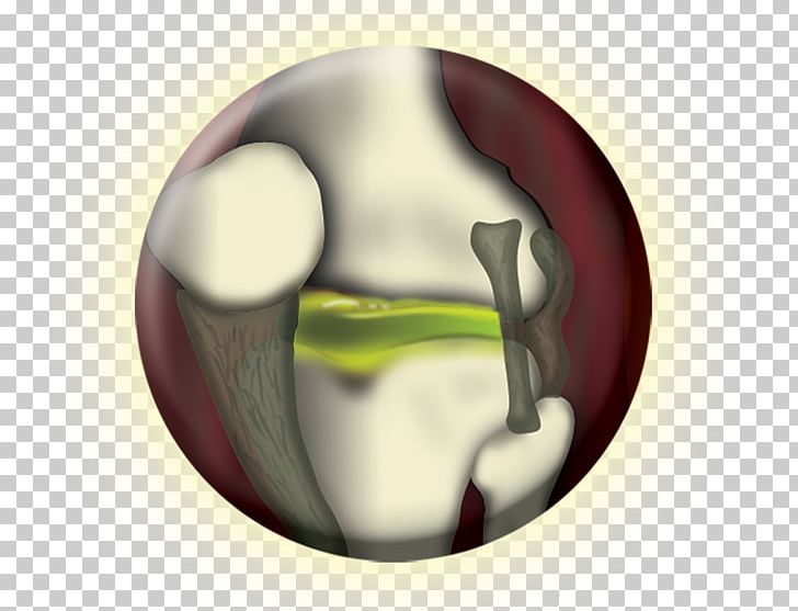 Joint Glucosamine Cartilage Chondroitin Sulfate Bone PNG, Clipart, Bone, Cartilage, Chloride, Chondroitin, Chondroitin Sulfate Free PNG Download