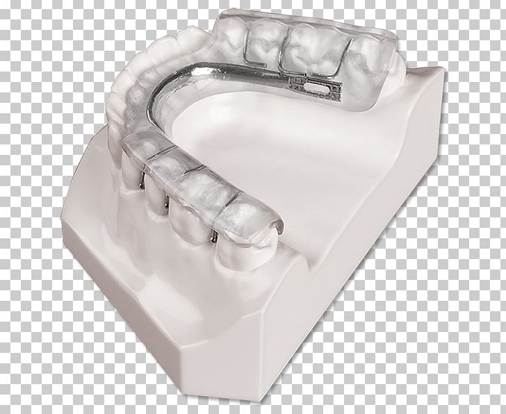 Splint Dentistry Temporomandibular Joint Dysfunction Therapy Orthopedic Surgery PNG, Clipart, Angle, Dentistry, Face, Home Appliance, Mandible Free PNG Download