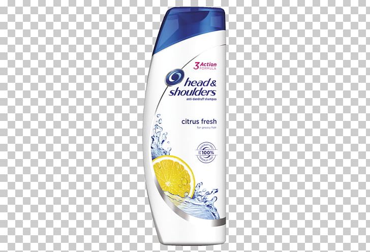 Head & Shoulders Classic Clean Shampoo Dandruff Greasy Hair PNG, Clipart, Body Wash, Citrus, Dandruff, Greasy Hair, Hair Free PNG Download
