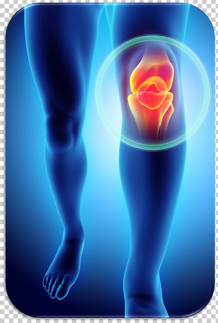 Knee Pain Patellofemoral Pain Syndrome Plica Syndrome Injury PNG, Clipart, Computer Wallpaper, Electric Blue, Energy, Health, Human Leg Free PNG Download