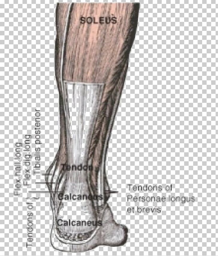 Achilles Tendon Achilles Tendinitis Muscle Injury PNG, Clipart,  Free PNG Download