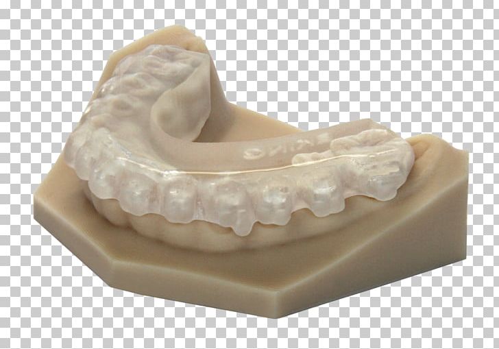 3D Printing EnvisionTEC Industry PNG, Clipart, 3d Printing, Dentist, Dentistry, Dentures, Envisiontec Free PNG Download