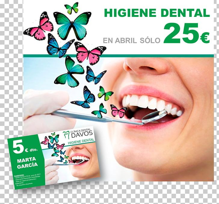 Dentistry Oral Hygiene Health Tooth Whitening PNG, Clipart, Advertising, Brand, Cosmetic Dentistry, Dental Implant, Dental Plaque Free PNG Download