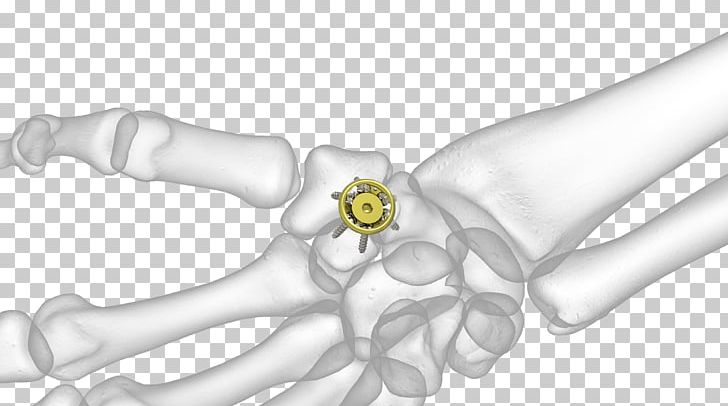 Thumb Hand Model Elbow Bone PNG, Clipart, Arm, Black And White, Body Jewelry, Bone, Cap Free PNG Download