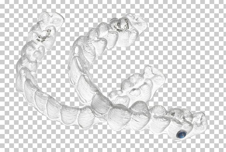 Clear Aligners Orthodontics Dental Braces Dentistry Therapy PNG, Clipart, Adolescence, Body Jewelry, Bracelet, Braces, Chain Free PNG Download