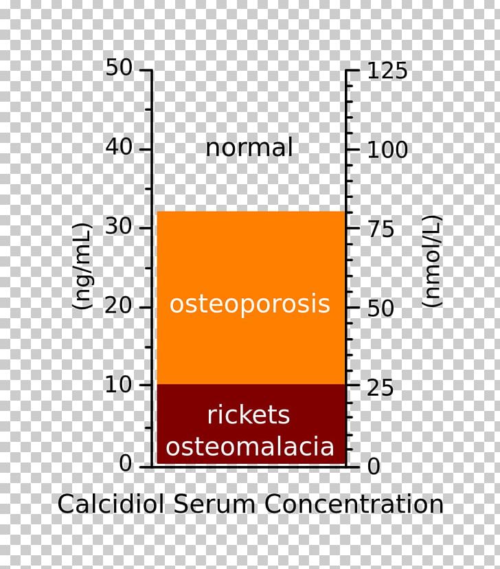 Nutrient Hypovitaminosis D Vitamin D Deficiency PNG, Clipart, Area, Brand, Calcifediol, Calcitriol Receptor, Cholecalciferol Free PNG Download