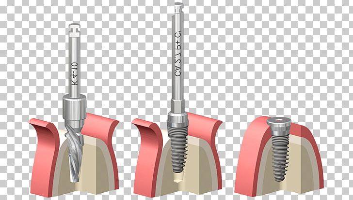 Household Cleaning Supply Tool PNG, Clipart, Cleaning, Dental Implant Cabinet, Household, Household Cleaning Supply, Tool Free PNG Download