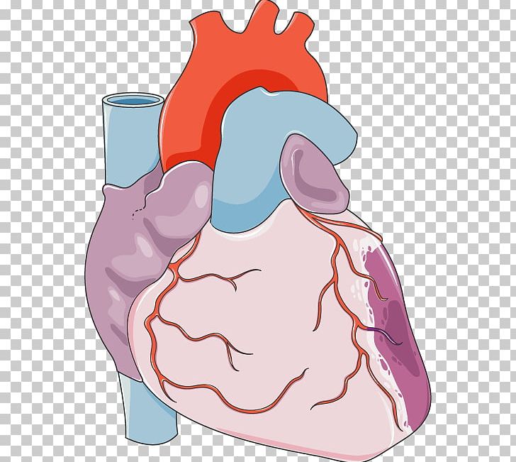 Heart Coronary Artery Bypass Surgery Coronary Artery Disease Cardiovascular Disease PNG, Clipart, Acute Myocardial Infarction, Adventitia, Art, Artery, Blood Vessel Free PNG Download