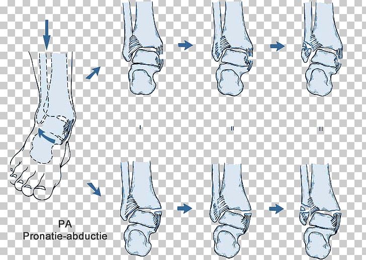 Finger Ankle Boston Celtics Shoe Foot PNG, Clipart, Alleyoop, Ankle, Arm, Boston Celtics, Cleveland Cavaliers Free PNG Download