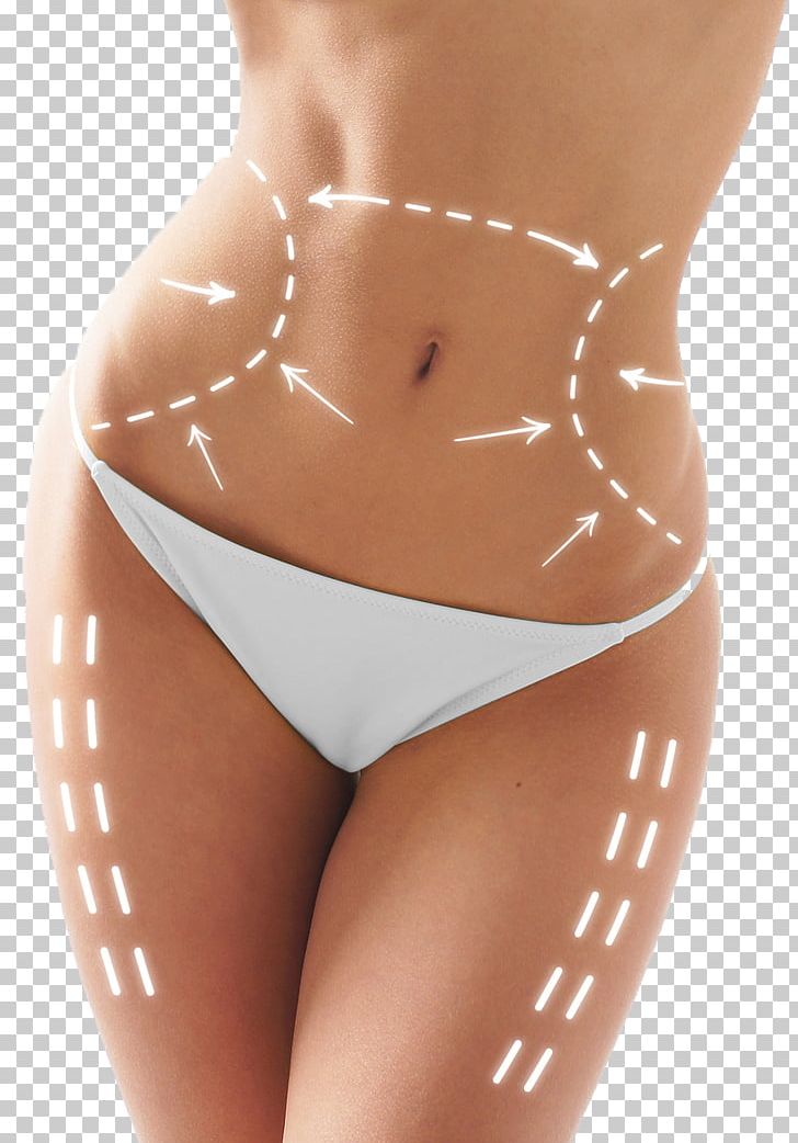 Laser Plastic Surgery Liposuction Body Contouring PNG, Clipart, Abdomen, Active Undergarment, Body Contouring, Hair Removal, Hip Free PNG Download
