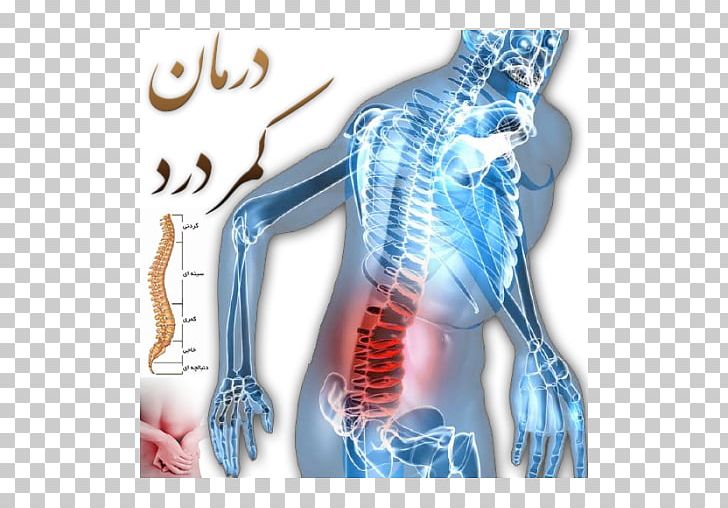 Pain In Spine Lumbar Disc Herniation Low Back Pain Vertebral Column PNG, Clipart, Arm, Back, Back Injury, Cervical Vertebrae, Degenerative Disc Disease Free PNG Download