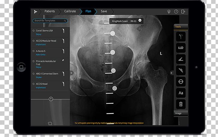 Orthopedic Surgery Computer Software PNG, Clipart, Apple, App Store, Computer Software, Electronics, Handheld Devices Free PNG Download