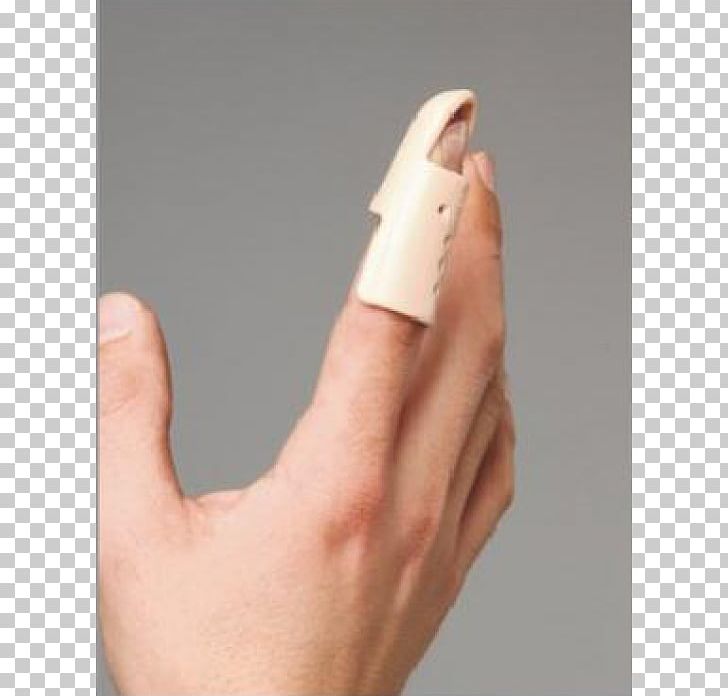 Splint Mallet Finger Hammer Toe Digit PNG, Clipart, Bandage, Calf, Digit, Finger, Finger Snapping Free PNG Download