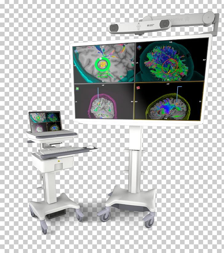 Synaptive Medical Table Neuronavigation Computer-assisted Surgery Information PNG, Clipart, Computerassisted Surgery, Desk, Display Device, Furniture, Information Free PNG Download