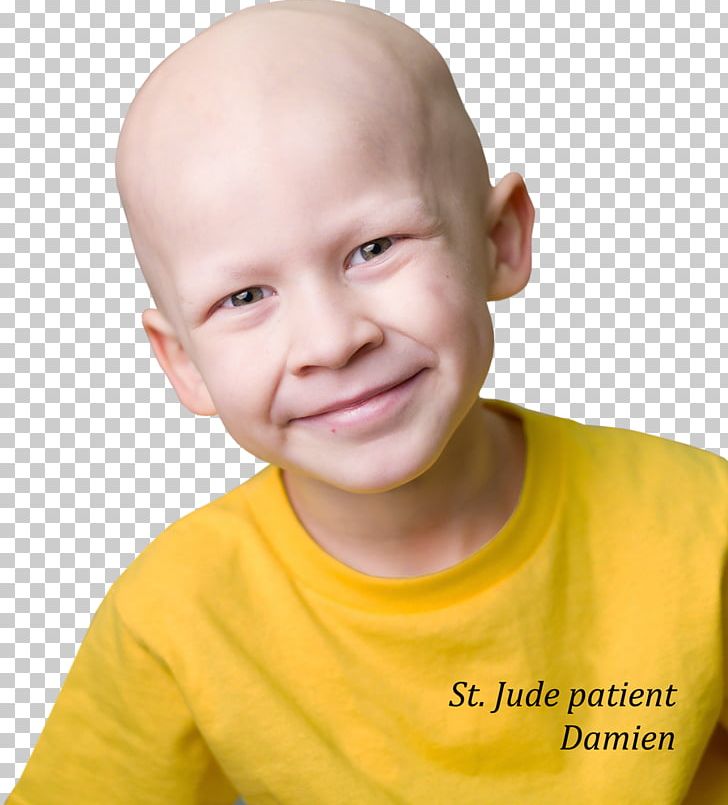 Nose Cheek Chin Jaw Forehead PNG, Clipart, Boy, Cancer Patient, Cheek, Child, Chin Free PNG Download