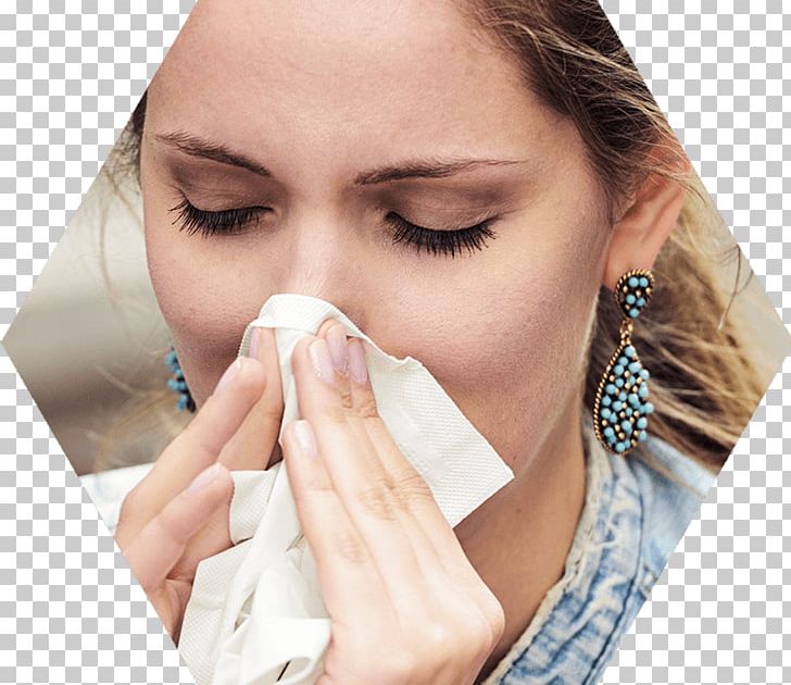 Nasal Congestion Nose Sneeze Common Cold Symptom PNG, Clipart, Affect, Beauty, Breathing, Canadian, Cheek Free PNG Download