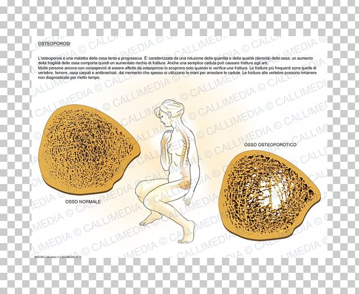 Commodity Organism PNG, Clipart, Art, Commodity, Food, Organism, Osteoporosis Free PNG Download