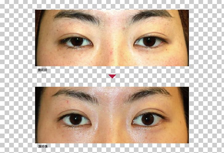 Eyebrow Eyelid Eyelash Extensions Primo Azabujuban Clinic PNG, Clipart, Cheek, Chin, Cosmetics, Eye, Eyebrow Free PNG Download