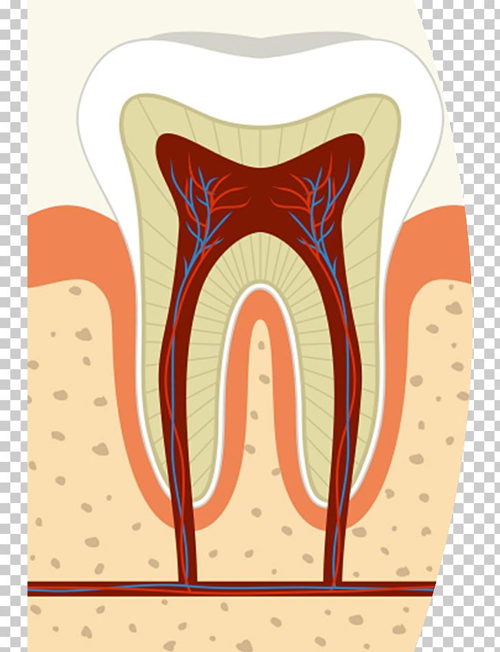Root Canal Dentistry Endodontic Therapy Pulp PNG, Clipart, Art, Crown, Dentist, Dentistry, Endodontic Therapy Free PNG Download