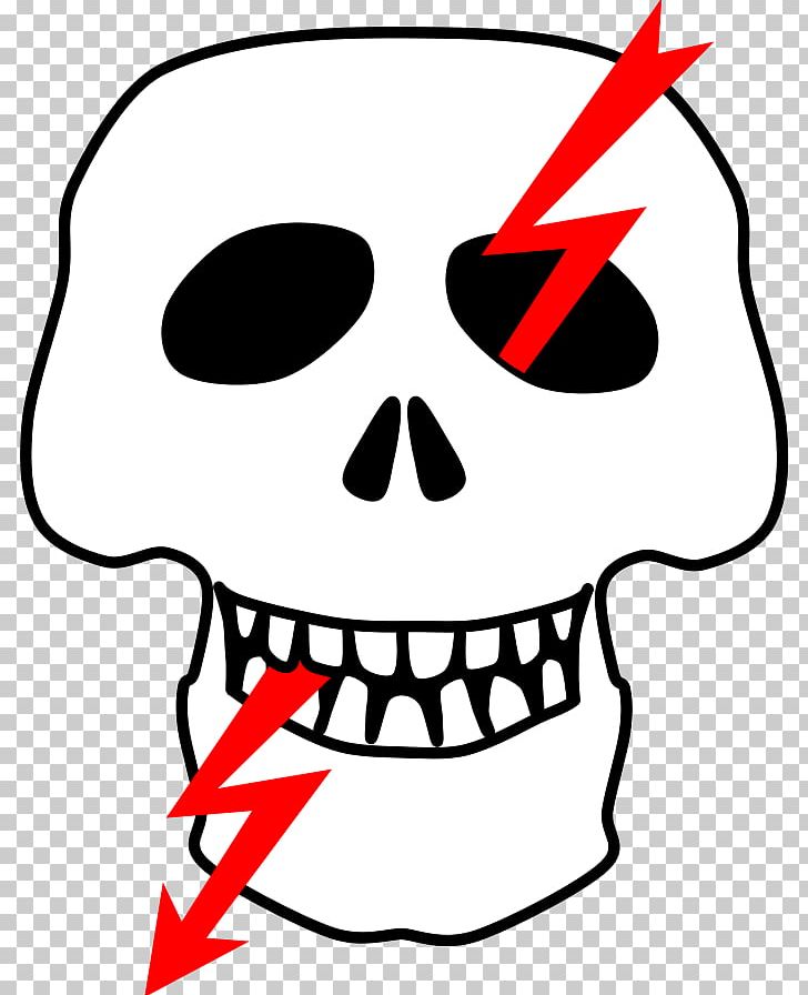 High Voltage Hazard Warning Sign PNG, Clipart, Black And White, Bone, Cheek, Computer Icons, Danger High Voltage Free PNG Download