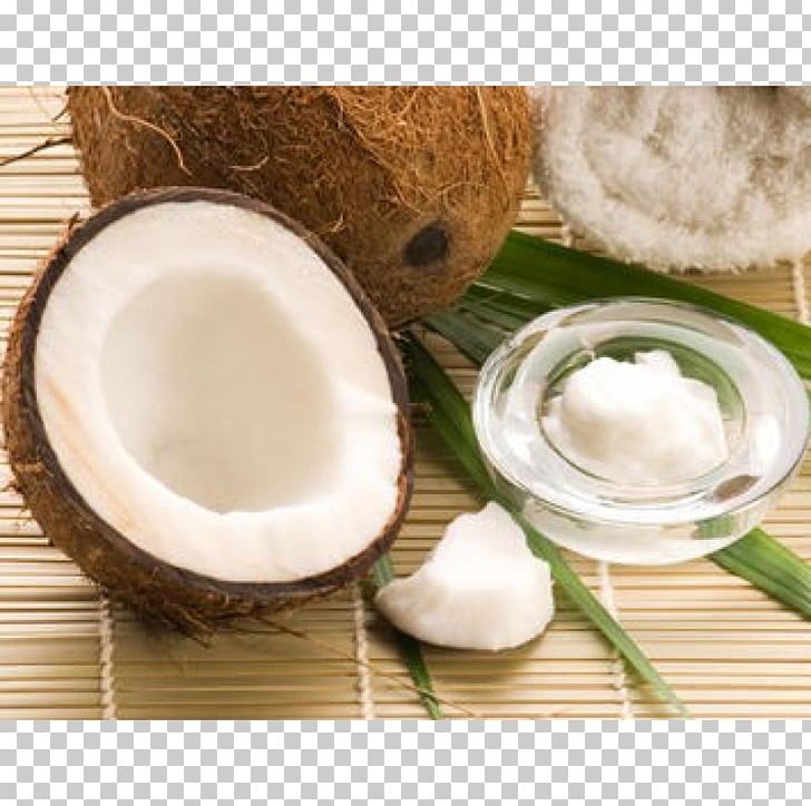 Coconut Oil Vegetable Oil Price PNG, Clipart, Artikel, Classified Advertising, Coconut, Coconut Oil, Cup Free PNG Download
