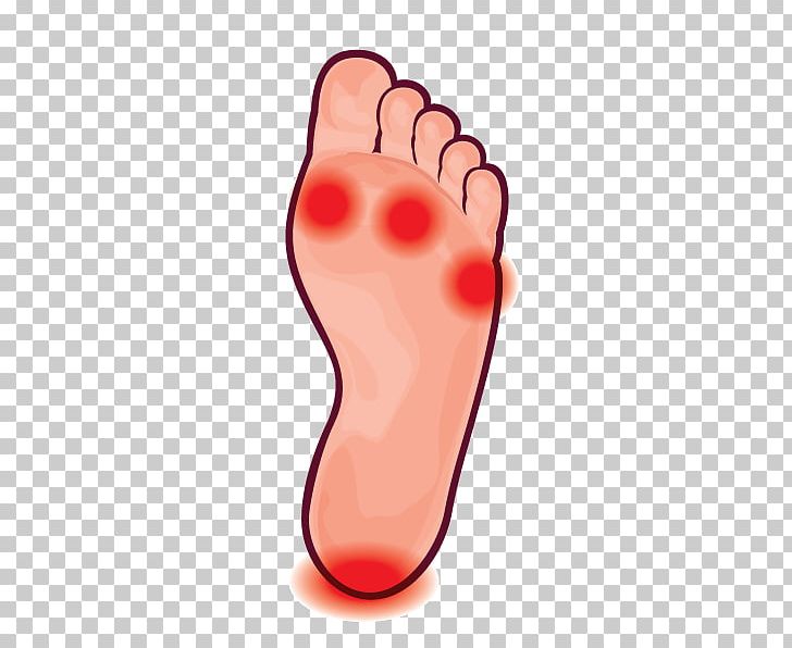 Toe Finger Shoe PNG, Clipart, Art, Callus, Comfort, Finger, Foot Free PNG Download