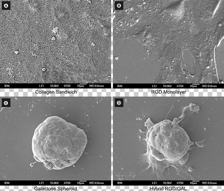 Computed Tomography Radiology Organism White PNG, Clipart, Black And White, Computed Tomography, Medical Imaging, Miscellaneous, Monochrome Free PNG Download