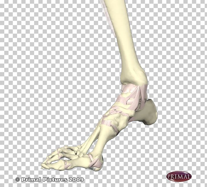 Finger Tailor's Bunion Foot Bunionectomy PNG, Clipart,  Free PNG Download