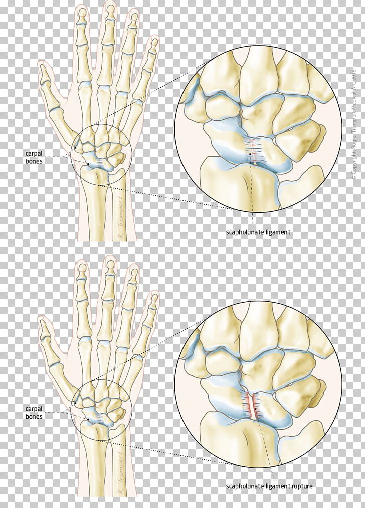 Finger Hand Model Bone Joint PNG, Clipart, Arm, Bone, Diagram, Finger, Hand Free PNG Download