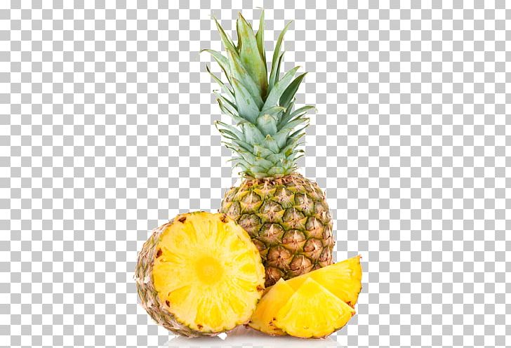 Ice Cream Wal-Mart 661 Supercenter Pineapple Fruit Conifer Cone PNG, Clipart, Ananas, Apple, Athens, Bromeliaceae, Canning Free PNG Download