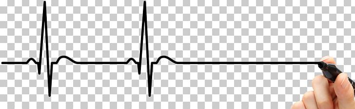 Electrocardiography Drawing Pulse Heart PNG, Clipart, Angle, Arm, Cardiovascular Disease, Child, Disease Free PNG Download