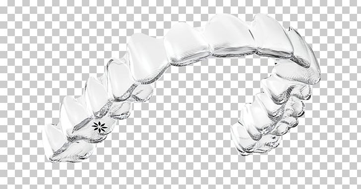 Clear Aligners Dental Braces Orthodontics Dentistry Tooth PNG, Clipart, Align Technology, Bangle, Black And White, Body Jewelry, Brace Free PNG Download