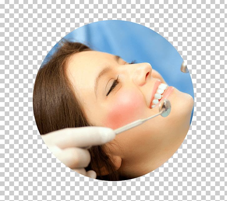 Dentistry Wisdom Tooth Tooth Decay PNG, Clipart, Cheek, Chin, Cosmetic Dentistry, Dental Extraction, Dental Restoration Free PNG Download