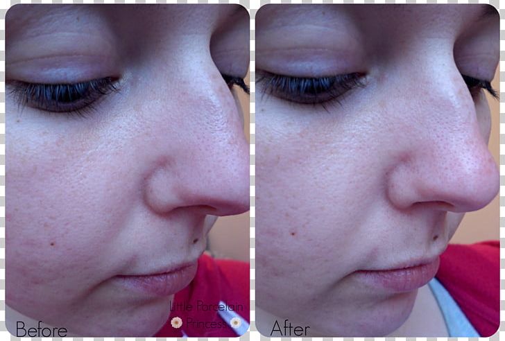 Eyelash Extensions Comedo Facial Nose Sebaceous Filament PNG, Clipart, Bb Cream, Cheek, Chin, Closeup, Comedo Free PNG Download