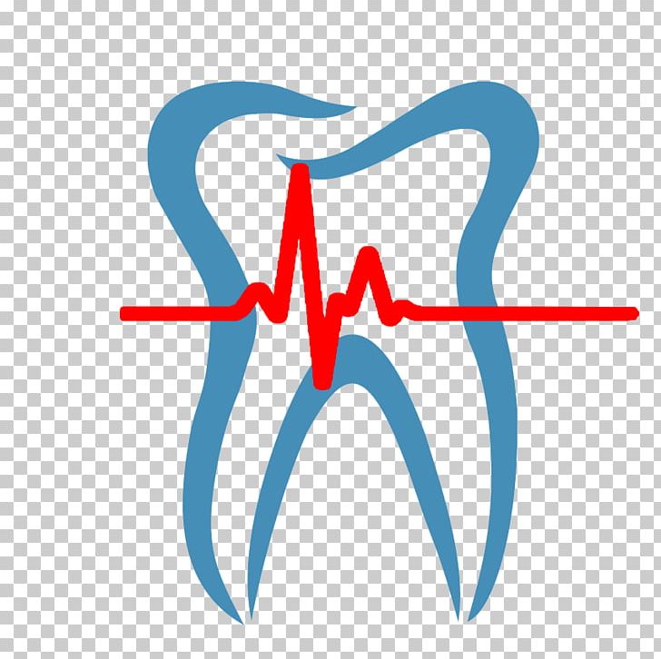 Dentistry Dental Surgery Endodontics Dental Implant PNG, Clipart, Angle, Area, Blue, Dent, Dental Hygienist Free PNG Download
