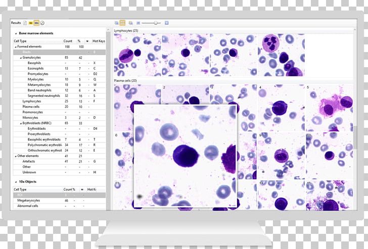 Bone Marrow Laboratory Neutrophil Analysis Corn Wet-milling PNG, Clipart, Analysis, Area, Bone, Bone Marrow, Bone Marrow Examination Free PNG Download