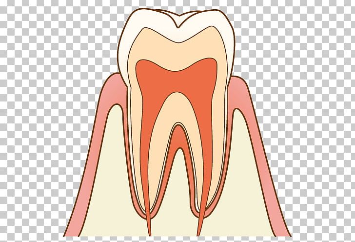 歯科 Dentist Tooth Brushing Tooth Decay Therapy PNG, Clipart, Angle, Dental Braces, Dentist, Disease, Ear Free PNG Download