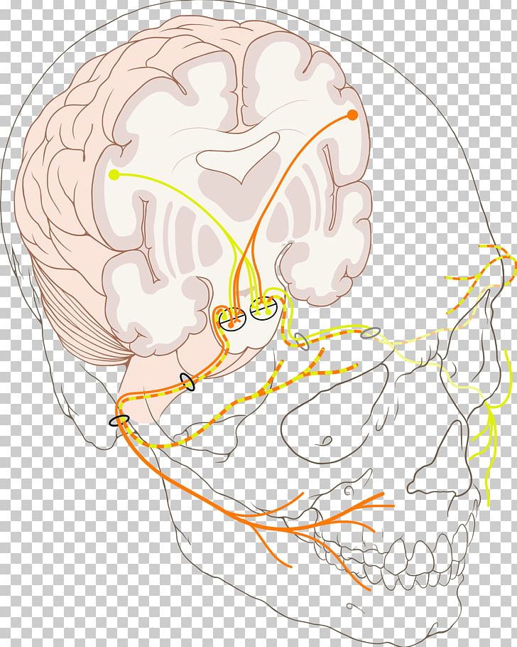 Facial Nerve Paralysis Bell's Palsy Cranial Nerves PNG, Clipart, Anatomy, Bells Palsy, Bone, Brain, Drawing Free PNG Download