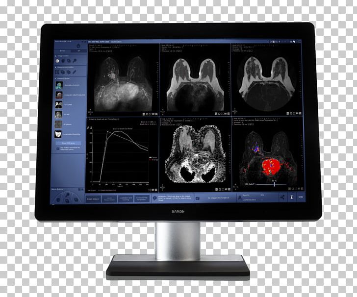 Computer Monitors Computer Mouse Computer Monitor Accessory Output Device PNG, Clipart, Breast Imaging, Computer, Computeraided Design, Computer Monitor, Computer Monitor Accessory Free PNG Download